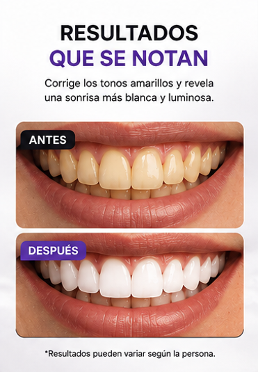 WhiteShift™ – Serum Corrector Violeta para una Sonrisa Más Luminosa